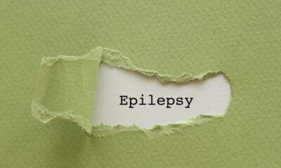 Temporal Lobe Epilepsy , Brain, Seizure, People, Chemical, Psychological